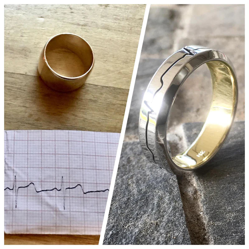 a custom ring portraying a heartbeat